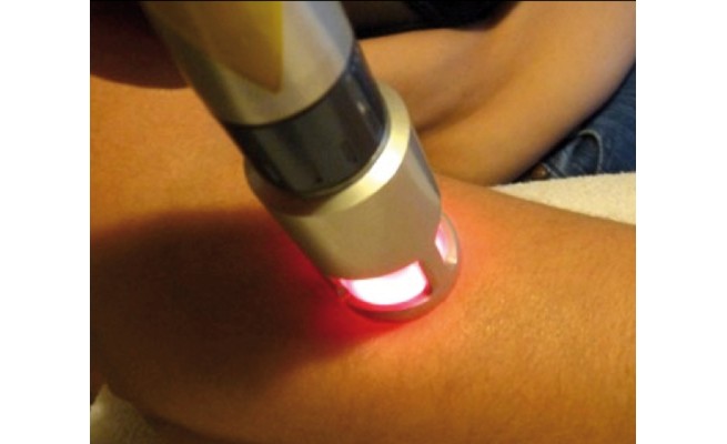 Mdk - Le laser : L'innovation thérapeutique en kinésithérapie