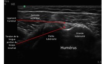 KS582P44.jpg