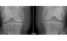 KS588P63.jpg
