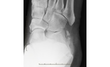 KS593P63.jpg