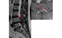 KS595P63.jpg