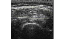 KS633P45.jpg