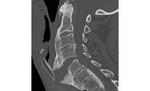 KS639P53.jpg