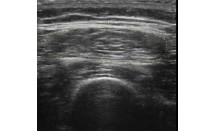 KS641P51.jpg