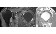 KS678P55.jpg
