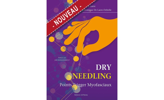 Dry Needling